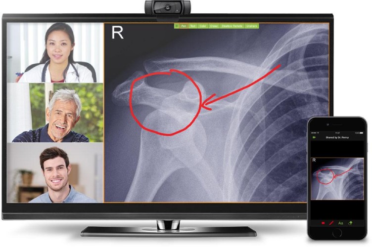 Virtual session with x-ray results on desktop and on mobile.